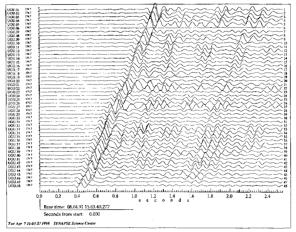 Synapse software applied: DGS result !